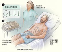 冠心病需要做哪些檢查？