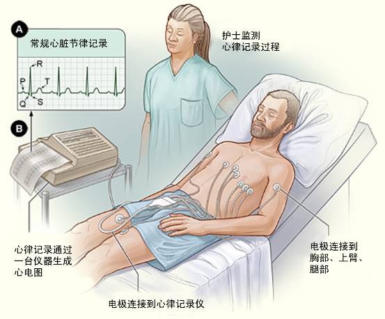冠心病需要做哪些檢查？(圖1)